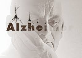 Alzheimer1