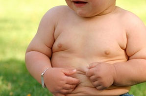Obesità Bambino1