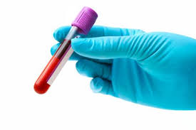 Sangue Provetta3
